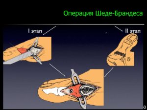 Операция Шэдэ-Брандеса