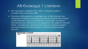 Неполная АВ-блокада 1 степени