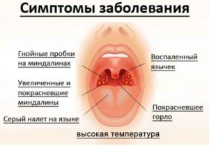 Ослабление иммунной системы, хронический тонзиллит, сыпь на теле