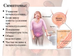 Ноет низ живота, ощущение неполного испражнения мочевого пузыря