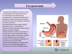 Панкреатин и эспумизан после фгдс