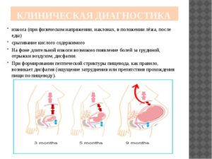 Отрыжка воздухом, изжога