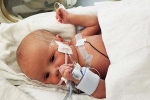 Новорожденный задерживает дыхание