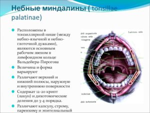 Образование на небной дужке