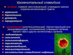 Хламидийная инфекция нижних отделов мочеполового тракта