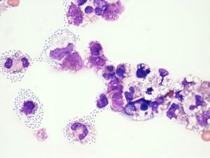 Neisseria sicca 10в6, streptococcus viridans group 10в6. haemophilus paranfluenzae 10в6