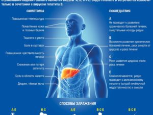 Гепатит С при онкологии что делать