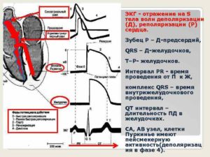 Неспецифические изменения фазы реполяризации на ЭКГ для мвд