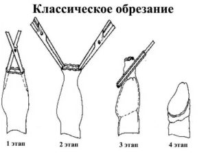 Не открывается головка после обрезания