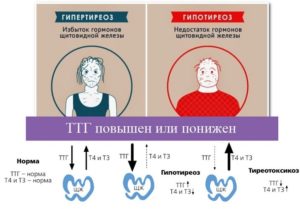 Очень снижен ТТГ и повышен пролактин