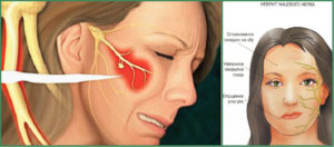 Онемение левой части лица и подергивание