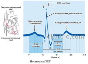 Неспецифические изменения фазы реполяризации на ЭКГ для мвд