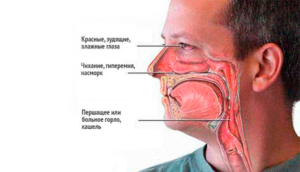 Отек горла и носоглотки