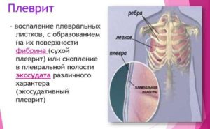 Небольшие боли после плеврита