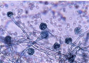 Паразитарные грибы микроскопия ногтя