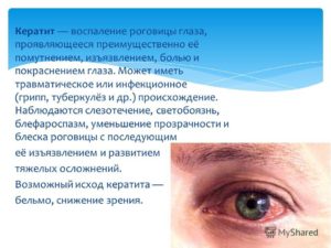 Осложнение на глаза при инфекционных болезнях