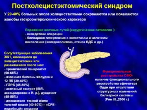 Гастрит, хр. Панкреатит, СРК или невроз