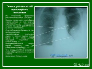 Описание рентгеновского снимка