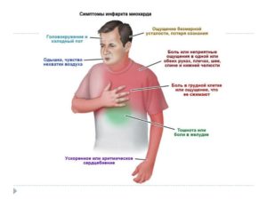 Непонятные спазмы ночью в сердце