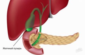 Холецистит, дискинизия, желчь, запах изо рта