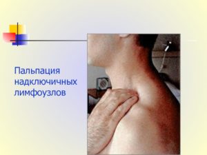 Низкие лейкоциты, надключичный лимфоузел