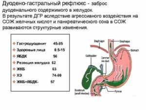 Недостаточность кардии. Эритиматозная гастропатия, дуодено-гастральный рефлекс