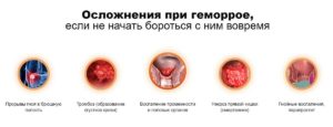 Некроз геммороидального узла при беременности
