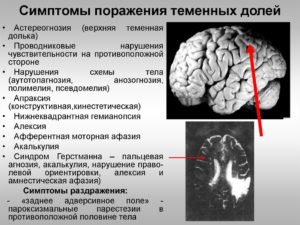 О чем говорят негрубые фокальные нарушения слева в теменно-центрально-височной доле?