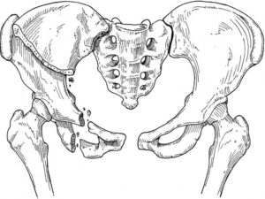 Перелом костей таза