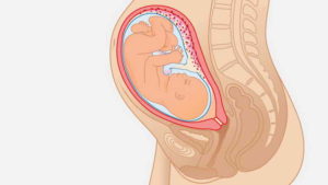 Низкое положение головки в 32-33 недели беременности