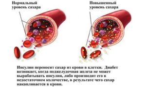 Гептрал и повышение уровня сахара в крови