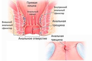 Непонятные ощущения в заднем проходе.