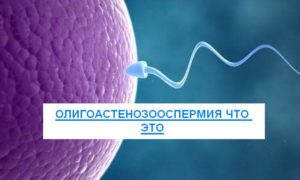 Олигоастенозооспермия