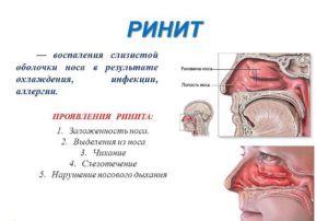 Нос заложен плохо дышит и красное горло