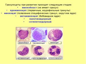 Нормобласты, метоциты и метамиелоциты в крови