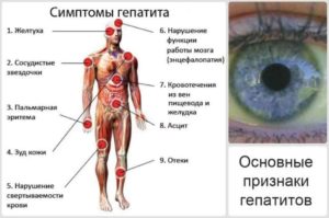 Гепатит С при онкологии что делать