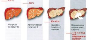 Гепатит С продолжительность 25 лет