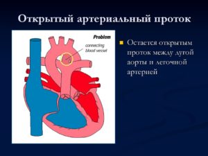 ООО и ОАП