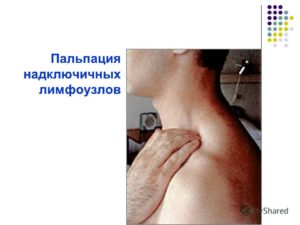 Низкие лейкоциты, надключичный лимфоузел