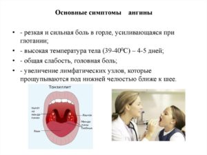 Головная боль отдает в зубы при хроническом тонзиллите