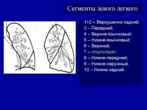 Округлый фокус в S8 нижней доли правого легкого