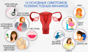 Нерегулярные менструации