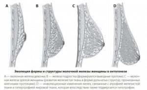 Непропорциональная форма груди