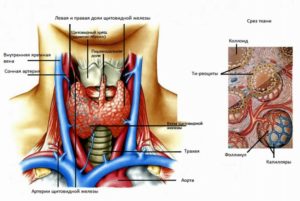 Образования в левой доле щитовидной железы