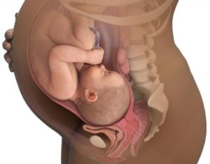 Гипоксия в 38 недель беременности