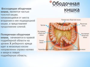 Образование ободочной кишки