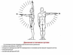 Ограниченная подвижность плеча