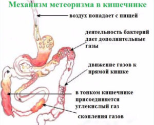 Не отходят газы