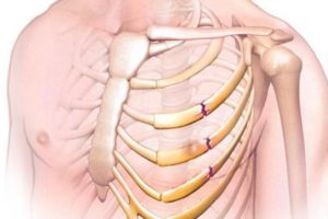 От удара болит грудная клетка