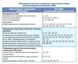 Папиломавирус ВПЧ 58